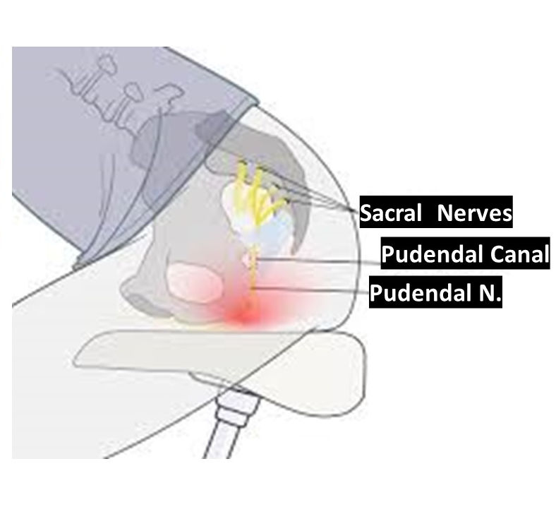 Cyklistsyndromet